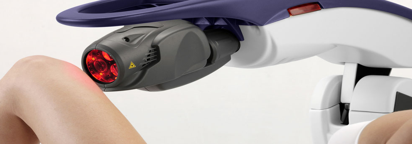 Laser a scansione Roma